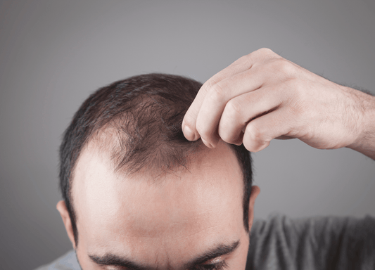 Spotting the Early Signs of Balding: Your Guide to Hair Health