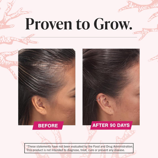 Best Hair Growth Tablets in UAE 