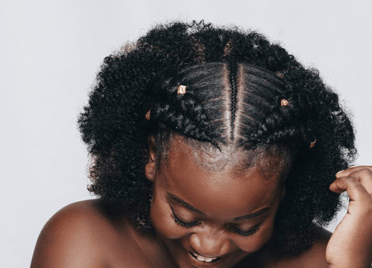 Traction Alopecia: Is Your Hairstyle Contributing to Your Hair Loss?