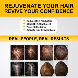 Revivogen MD Bio-Cleansing Shampoo