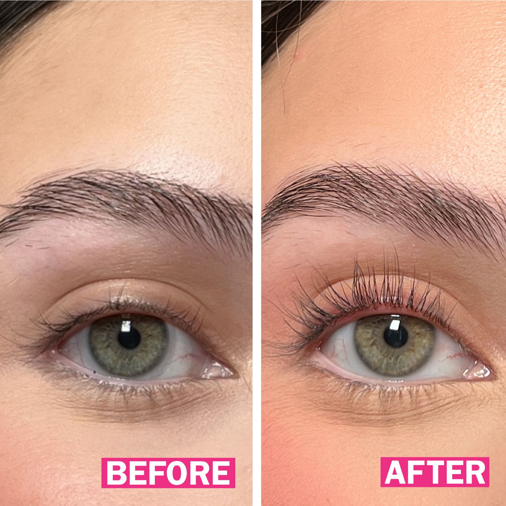 before and after