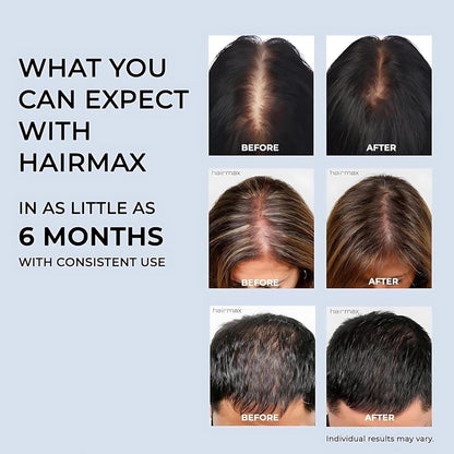 HairMax Lumina 272 Laser Cap – FDA-Cleared Full-Scalp LLLT Device for Hair Loss and Regrowth (Hair Care & Hair Regrowth)