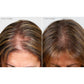 Hairmax LaserBand 41 Comfortflex (FDA Cleared)